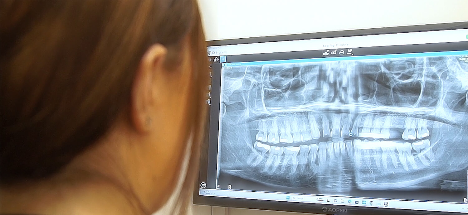 Teeth X-Rays